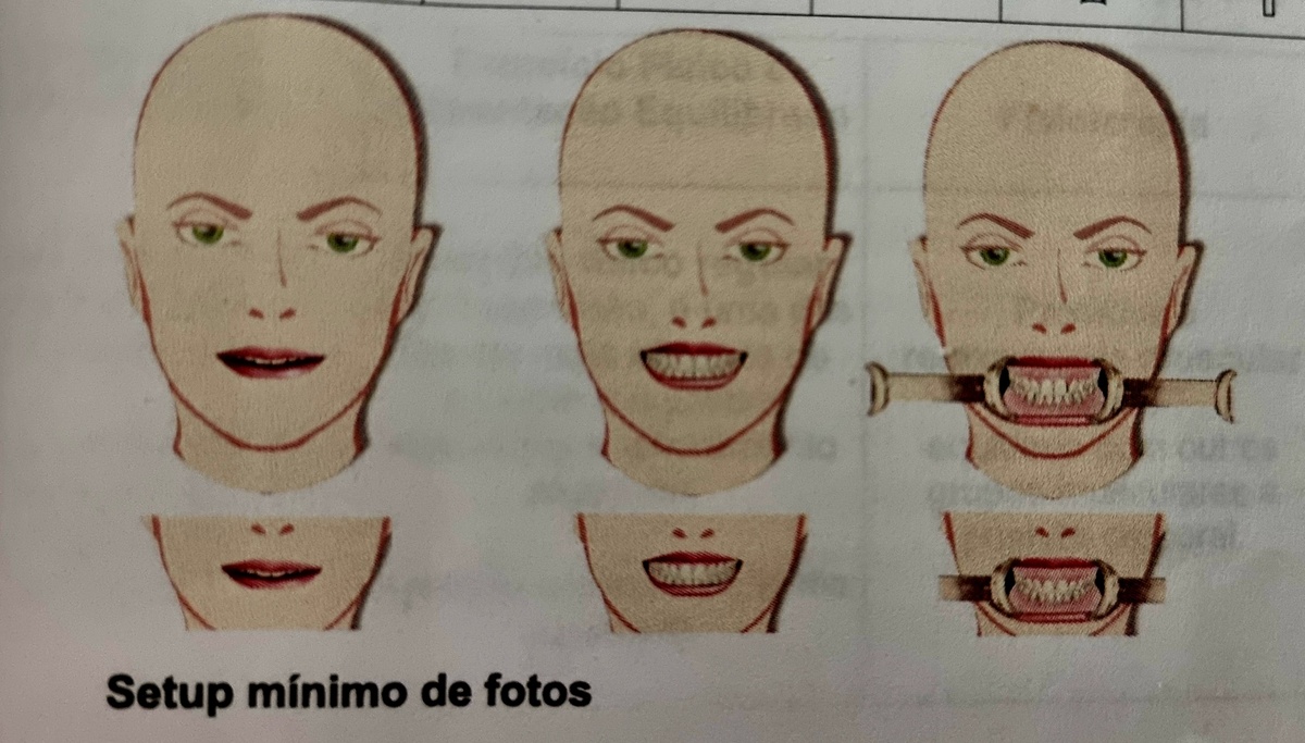 fotografias smile design